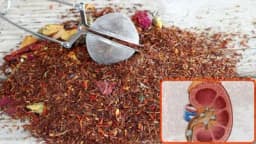 Liječenje kamenca u bubregu uz pomoć ove mješavine čaja koju možete sami napraviti