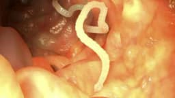 Paraziti koji vrebaju u našoj hrani - Nevidljiva opasnost!