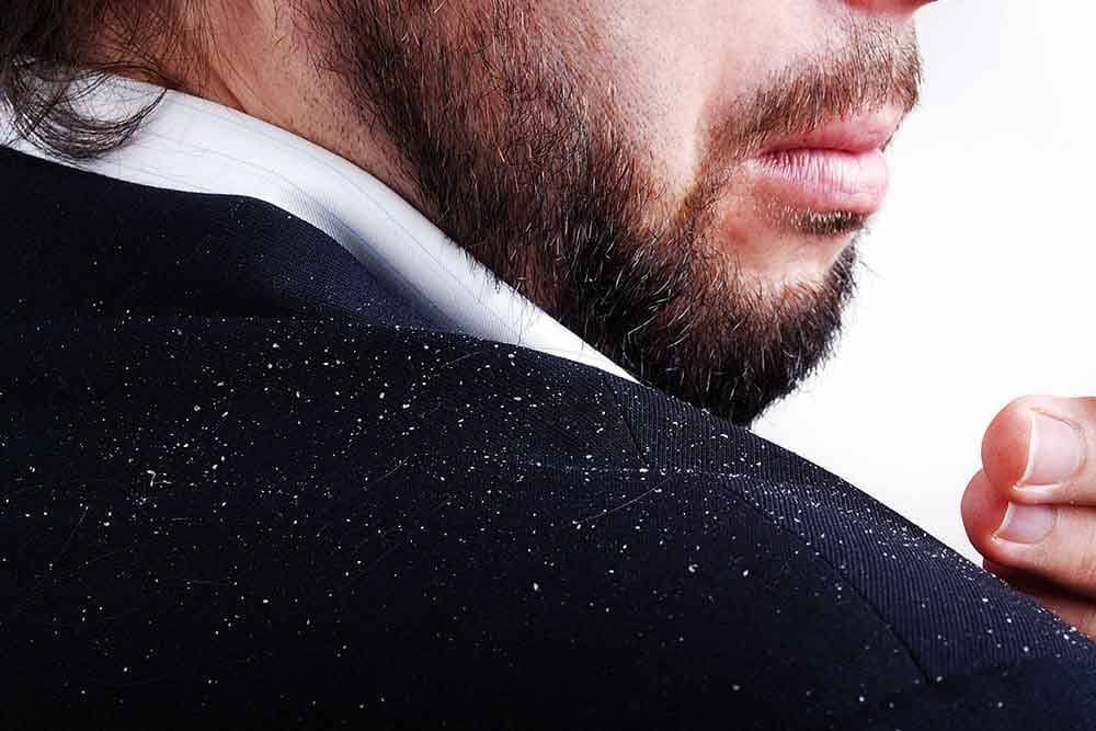 Uništite perut uz pomoć prirodnih lijekova