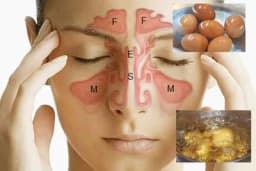 SINUSI - Stare metode liječenja koje brzo pomažu